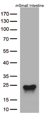 Cytoglobin (CYGB) Antibody in Western Blot (WB)