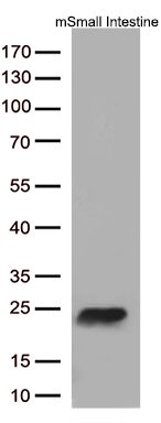 Cytoglobin (CYGB) Antibody in Western Blot (WB)