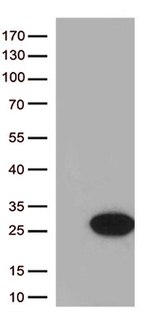 Cytoglobin (CYGB) Antibody in Western Blot (WB)