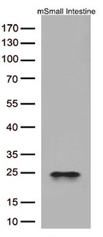 Cytoglobin (CYGB) Antibody in Western Blot (WB)