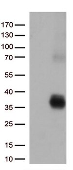 HLA-DQA2 Antibody in Western Blot (WB)