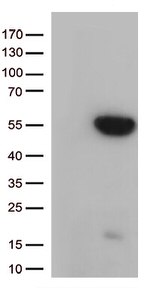GNAL Antibody in Western Blot (WB)