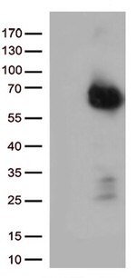 p75 NGF Receptor (NGFR) Antibody in Western Blot (WB)