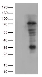 Lymphocyte Activation Gene 3 (LAG3) Antibody in Western Blot (WB)