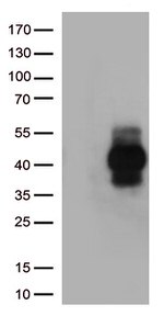 TIGIT Antibody in Western Blot (WB)
