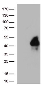 TIGIT Antibody in Western Blot (WB)