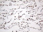 EWSR1 Antibody in Immunohistochemistry (Paraffin) (IHC (P))