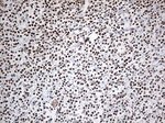 EWSR1 Antibody in Immunohistochemistry (Paraffin) (IHC (P))