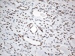 EWSR1 Antibody in Immunohistochemistry (Paraffin) (IHC (P))