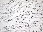 EWSR1 Antibody in Immunohistochemistry (Paraffin) (IHC (P))
