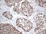EWSR1 Antibody in Immunohistochemistry (Paraffin) (IHC (P))