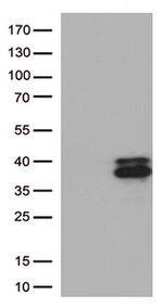 Major Basic Protein (PRG2) Antibody in Western Blot (WB)