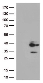 Major Basic Protein (PRG2) Antibody in Western Blot (WB)