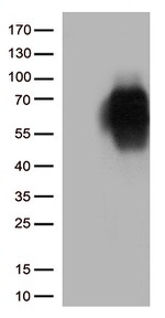 B7-2 (CD86) Antibody in Western Blot (WB)