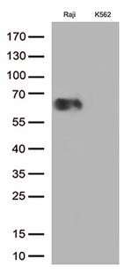 B7-2 (CD86) Antibody in Western Blot (WB)