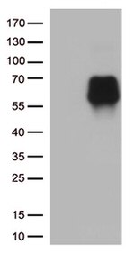 B7-2 (CD86) Antibody in Western Blot (WB)