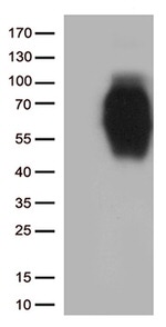B7-2 (CD86) Antibody in Western Blot (WB)