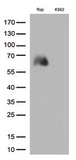 B7-2 (CD86) Antibody in Western Blot (WB)