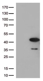 AMPK beta 1 (PRKAB1) Antibody in Western Blot (WB)