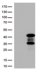 AMPK beta 1 (PRKAB1) Antibody in Western Blot (WB)