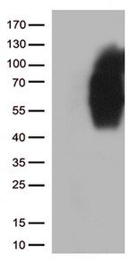 B7-2 (CD86) Antibody in Western Blot (WB)