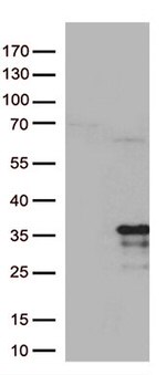 MRPL24 Antibody in Western Blot (WB)