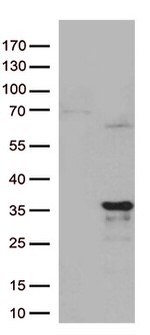 MRPL24 Antibody in Western Blot (WB)