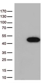 Arginase 1 (ARG1) Antibody in Western Blot (WB)