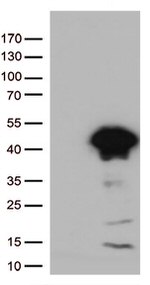 Arginase 1 (ARG1) Antibody in Western Blot (WB)
