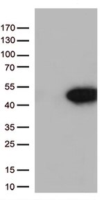 Arginase 1 (ARG1) Antibody in Western Blot (WB)