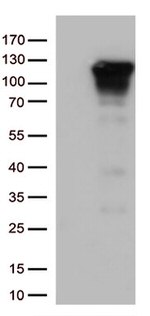NFKB1 Antibody in Western Blot (WB)