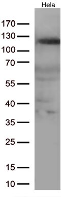 NFKB1 Antibody in Western Blot (WB)