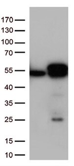 Calreticulin (CALR) Antibody in Western Blot (WB)