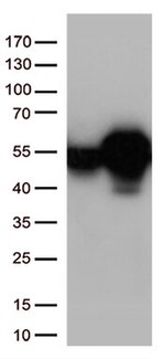 Calreticulin (CALR) Antibody in Western Blot (WB)