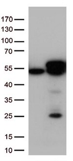 Calreticulin (CALR) Antibody in Western Blot (WB)