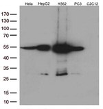 Calreticulin (CALR) Antibody in Western Blot (WB)