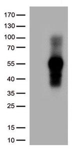 TNFRSF14 Antibody in Western Blot (WB)