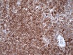 Caspase 3 (CASP3) Antibody in Immunohistochemistry (Paraffin) (IHC (P))