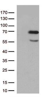 Nucleostemin (GNL3) Antibody in Western Blot (WB)