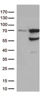 Nucleostemin (GNL3) Antibody in Western Blot (WB)