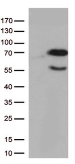 Nucleostemin (GNL3) Antibody in Western Blot (WB)