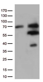 Nucleostemin (GNL3) Antibody in Western Blot (WB)