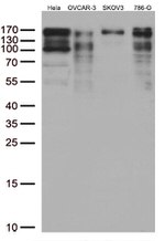 LARP1 Antibody in Western Blot (WB)