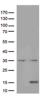 IL8 (CXCL8) Antibody in Western Blot (WB)