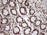 KAP1 (TRIM28) Antibody in Immunohistochemistry (Paraffin) (IHC (P))