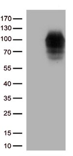 DDX4 Antibody in Western Blot (WB)