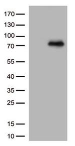 PRKCA Antibody in Western Blot (WB)