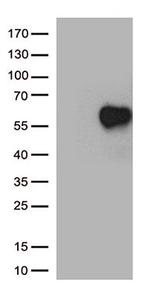 IL2RA Antibody in Western Blot (WB)