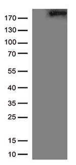MAP2 Antibody in Western Blot (WB)
