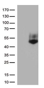 FCGR3A Antibody in Western Blot (WB)
